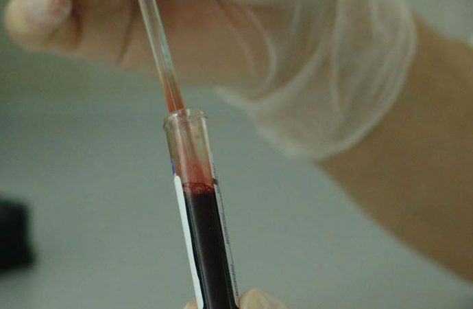 ‘Her 3 saatte 1 çocuğa kanser teşhisi konuluyor’