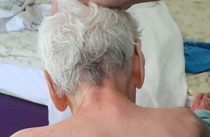 Huzurevindeki ölüm olayıyla ilgili beklenen rapor sonunda geldi ve yapılan incelemeler sonucunda dermatolojik bir hastalığa rastlanmadığı belirlendi.