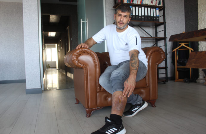 Bir birey, bacağında unutulan bir bez parçasıyla tam 16 yıl boyunca yaşamını sürdürdü.
