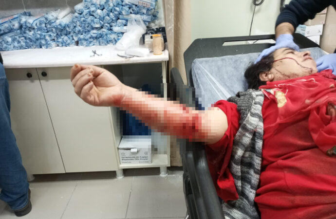Yasaklı bir ırka mensup olan köpeğin saldırısına maruz kalan bir kadın, yaralanmıştır.