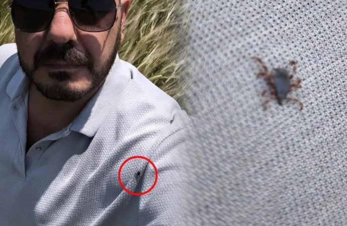 Çektiği fotoğrafta fark etti, üstünden 25 kene silkeledi