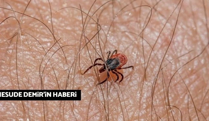 Türkiye’de 30 il ‘hiperendemik’ kene bölgesi