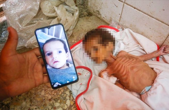 İsrail’in Gazze’deki son kurbanı: Açlıktan ölen 3 aylık bebek Curi