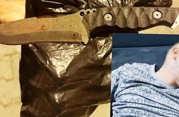 İki kadının ‘İmdat’ çağrısına gelen polisi bıçakladı