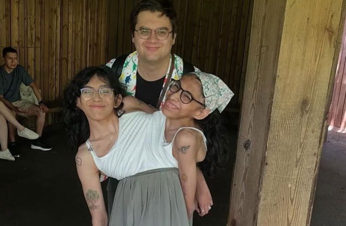 Yapışık ikizlerden biri evlendi: Diğeri ömür boyu bekar kalacak