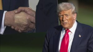 Trump’ın sağlığıyla ilgili açıklama: Kronik damar yetmezliği var