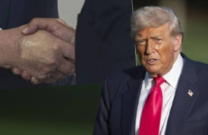 Trump’ın sağlığıyla ilgili açıklama: Kronik damar yetmezliği var