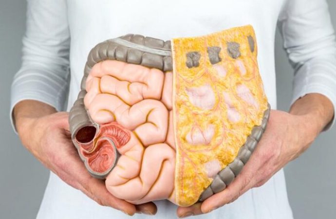 Bağırsak Geçirgenliği Nedir?