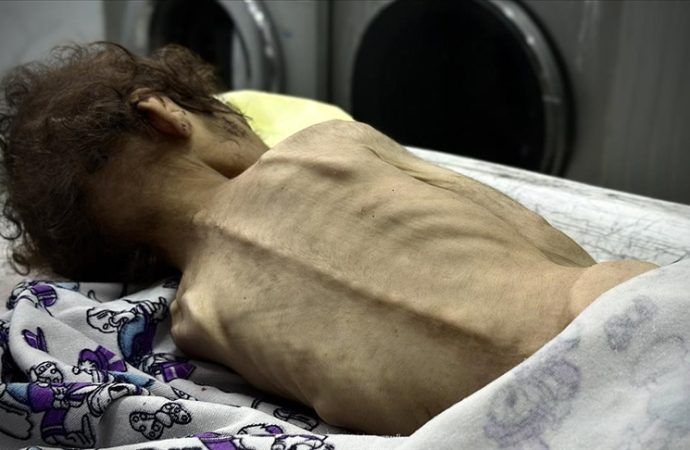 Gazze’de yeni cinayet: İkisi çocuk dört kişi daha açlıktan hayatını kaybetti