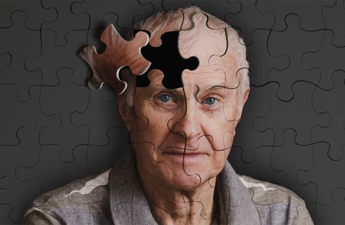 Bilim dünyasından sevindiren keşif: Belki de Alzheimer’ın nedeni bulundu