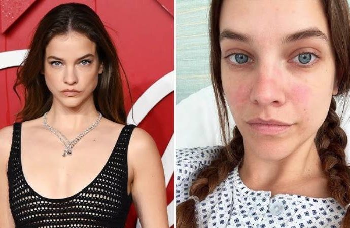 Süper model Barbara Palvin gizli hastalığını açıkladı: Endometriozis