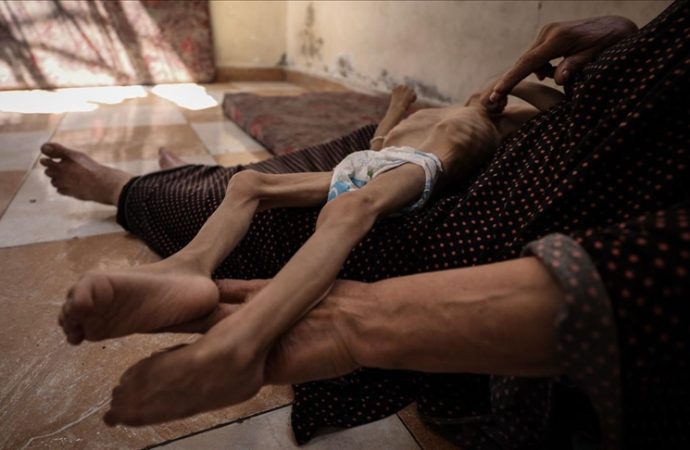 Gazze’de ikisi çocuk beş kişi daha açlıktan öldü