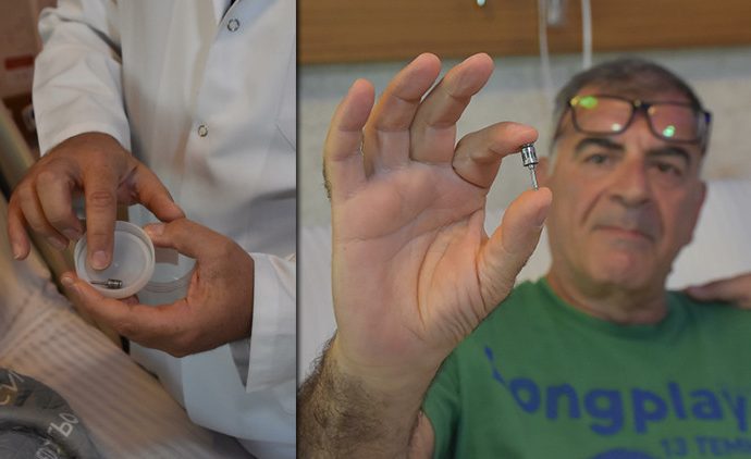 Akciğerine diş implantı kaçmış, öksürünce fark etti