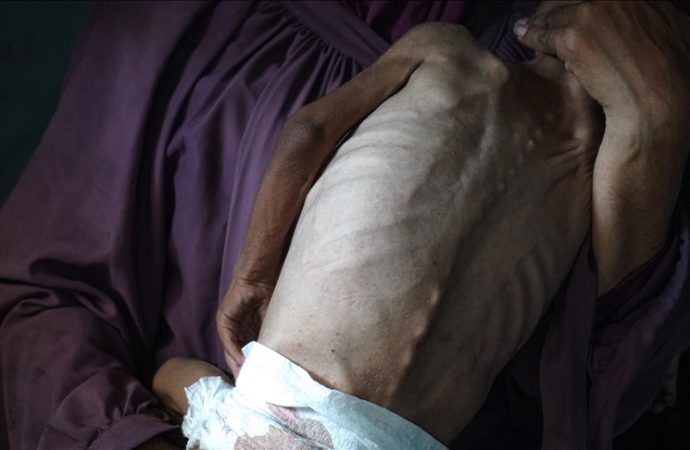 Gazze’de biri çocuk altı kişi daha açlıktan öldü