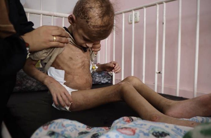 UNRWA: Gazze’de üç yaş altı her üç çocuktan biri son 24 saati aç geçirdi