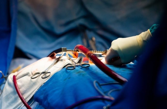 Organ naklinde çığır açacak gelişme! Bilim insanları böbreğin kan grubunu değiştirdi