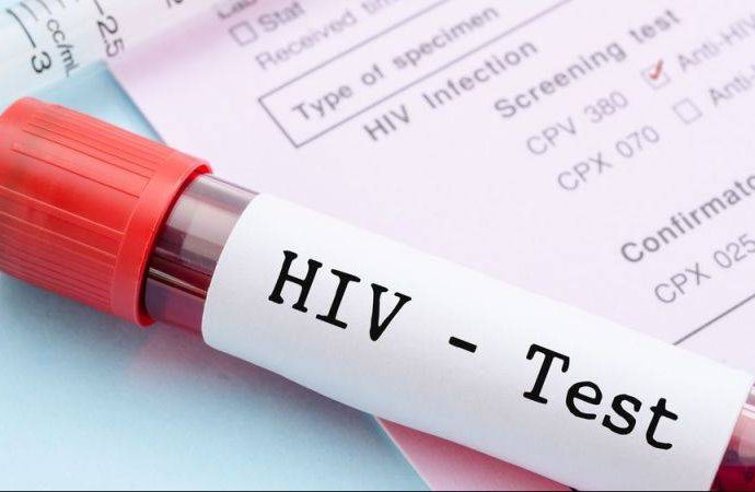 Dünyada 40,8 milyon kişi HIV ile yaşıyor