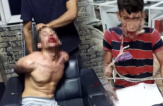 Böcek yedirip dişlerini kırmışlardı: İstenen ceza belli oldu