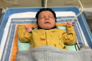 Doğumda beyin hasarını tespit eden başlık geliştirildi