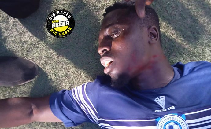 Akılalmaz olay: Taraftar futbolcunun boğazını kesti, hakem maçı kaldığı yerden devam ettirdi!