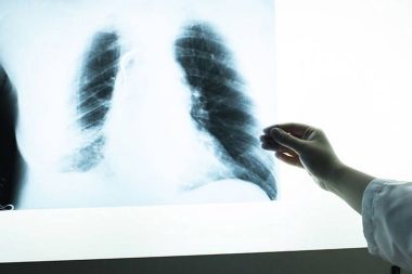 Beş kişiden biri KOAH hastası ama farkında değil