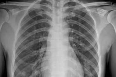 Hekimlerimize Neoliberalizmden Kalan Bir Röntgen