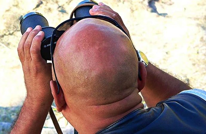 Yeni kellik ilacı ümit verdi: Yüzde 539 oranında saç artışı