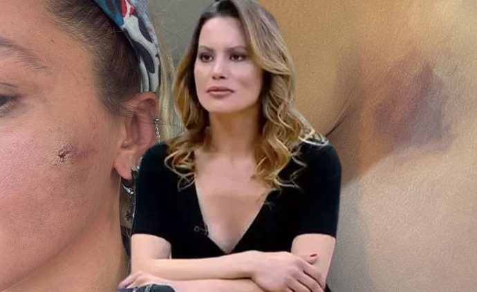 Ünlü oyuncu Yıldız Asyalı’dan iddia: Kocam tarafından darp edildim!