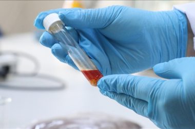 Üzüm posasından yüksek değerli tek hücre yağı üretildi