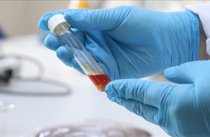 Üzüm posasından yüksek değerli tek hücre yağı üretildi