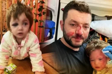 Odunla 14 aylık bebeğe saldırmak