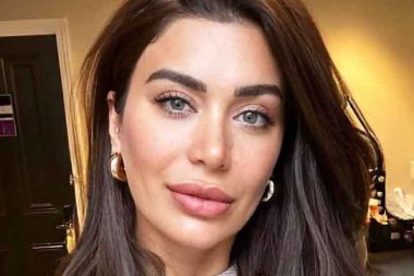 Ebru Şancı botoks kurbanı: Mr. Spock gibi oldum