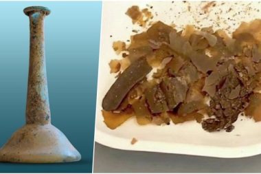 Dışkı Antik Roma’da ilaç olarak kullanılmış: İlk kanıt Türkiye’den