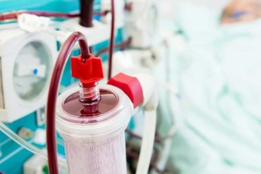 2,2 milyon ödeyip kanını ‘süzdürdü’: Ünlülerin yeni gençlik formülü