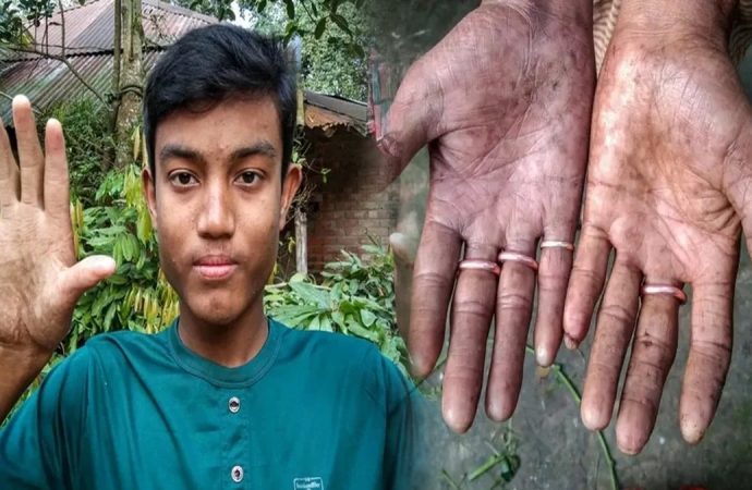 Milyarlarca insanda var sadece onlarda yok: Bu yüzden ‘yok’ sayılıyorlar