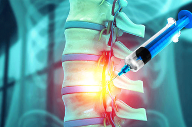 Bel fıtığı ağrıları: Enjeksiyonla rahatlamak mümkün mü?