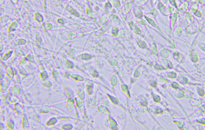 Araştırma: Spermler yazın daha hızlı yüzüyor