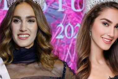 Birinciliği tartışılıyordu: Türkiye güzeli sağlık testi paylaştı, eleştiri yağdı