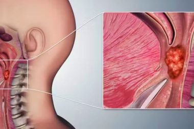 Kimin aklına gelir: Gırtlak kanserinin baş nedeni oral seks