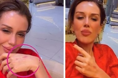 Dilan Polat takipçilerini korkuttu: Bana ne olur çare…