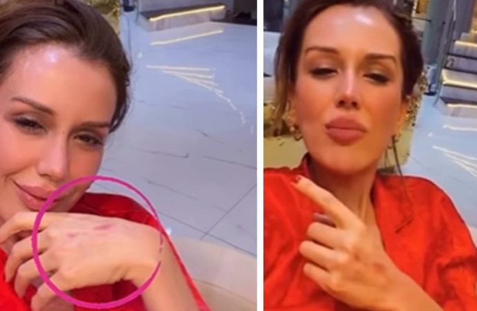 Dilan Polat takipçilerini korkuttu: Bana ne olur çare…