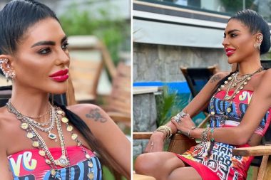 Sosyetik ismin iğne ipliğe dönmüş hali korkuttu