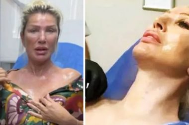 Güzellik sırrını açıkladı: Tavada pişen et gibi yaktırmış