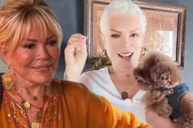 Tedavi bitti, perukla vedalaştı