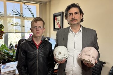 Yüzünün şekil bozukluğu ‘3 boyutlu teknoloji’yle düzeltildi